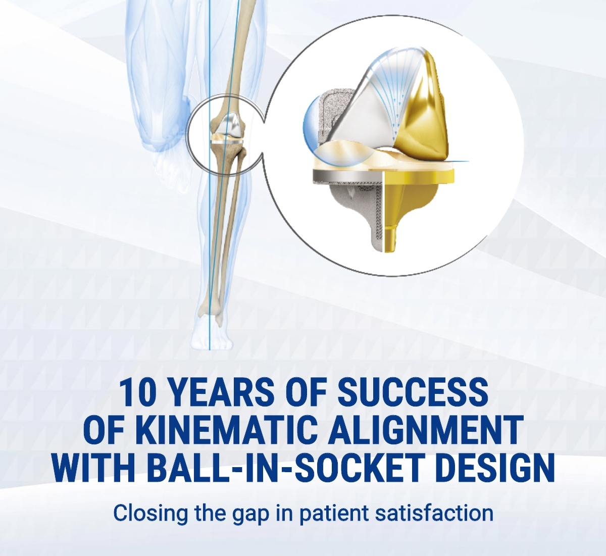 健康・医学 Aligner generation Full article: Clear aligners generations and orthodontic